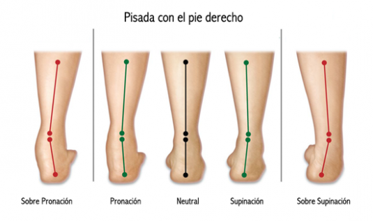 ¿pie Pronador Supinador O Neutroemk 6260